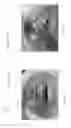 Fig. 33 - Device, system, and method for transcatheter treatment of valvular regurgitation