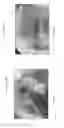 Fig. 34 - Device, system, and method for transcatheter treatment of valvular regurgitation