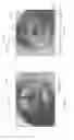 Fig. 35 - Device, system, and method for transcatheter treatment of valvular regurgitation