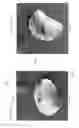 Fig. 40 - Device, system, and method for transcatheter treatment of valvular regurgitation