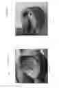 Fig. 43 - Device, system, and method for transcatheter treatment of valvular regurgitation