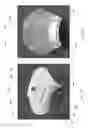 Fig. 65 - Device, system, and method for transcatheter treatment of valvular regurgitation