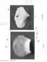 Fig. 66 - Device, system, and method for transcatheter treatment of valvular regurgitation