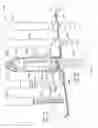 Fig. 69 - Device, system, and method for transcatheter treatment of valvular regurgitation