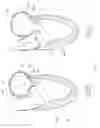 Fig. 94 - Device, system, and method for transcatheter treatment of valvular regurgitation