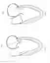 Fig. 96 - Device, system, and method for transcatheter treatment of valvular regurgitation