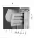 Fig. 02 - Customized bendable osteochondral allografts