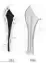 Fig. 02 - SHOULDER PROSTHESIS COMPONENT, SUCH AS A HUMERAL COMPONENT OR A GLENOID COMPONENT, FOR A PATIENT, AND METHOD FOR PRODUCING SUCH A SHOULDER PROSTHESIS COMPONENT FOR A PATIENT