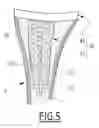Fig. 04 - SHOULDER PROSTHESIS COMPONENT, SUCH AS A HUMERAL COMPONENT OR A GLENOID COMPONENT, FOR A PATIENT, AND METHOD FOR PRODUCING SUCH A SHOULDER PROSTHESIS COMPONENT FOR A PATIENT
