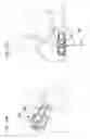 Fig. 19 - Expandable implant