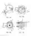 Fig. 11 - Bone graft delivery revolver