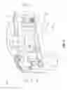 Fig. 07 - Prosthetic attachment device for osseointegrated implants