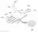 Fig. 01 - ELASTIC BAND FOR CORRECTING JOINT DEFORMITY AND ENHANCING JOINT FUNCTION, AND DEVICE FOR MOUNTING SAME