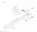 Fig. 02 - ELASTIC BAND FOR CORRECTING JOINT DEFORMITY AND ENHANCING JOINT FUNCTION, AND DEVICE FOR MOUNTING SAME
