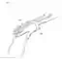 Fig. 06 - ELASTIC BAND FOR CORRECTING JOINT DEFORMITY AND ENHANCING JOINT FUNCTION, AND DEVICE FOR MOUNTING SAME