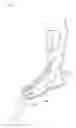 Fig. 08 - ELASTIC BAND FOR CORRECTING JOINT DEFORMITY AND ENHANCING JOINT FUNCTION, AND DEVICE FOR MOUNTING SAME