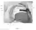 Fig. 09 - HEAD IMMOBILIZATION AID WITH ADJUSTABLE SUPPORTS