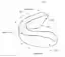 Fig. 01 - Oral appliance and method for manufacturing the same