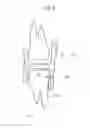 Fig. 07 - Oral appliance and method for manufacturing the same