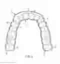 Fig. 06 - MANDIBLE SUPPORT DEVICE FOR USE WITH A POSITIVE AIRFLOW PRESSURE DEVICE