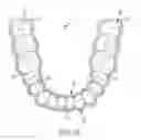Fig. 07 - MANDIBLE SUPPORT DEVICE FOR USE WITH A POSITIVE AIRFLOW PRESSURE DEVICE