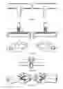 Fig. 05 - Hyperthermic vessel treatment devices and methods and kits utilizing the same