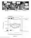 Fig. 20 - Hyperthermic vessel treatment devices and methods and kits utilizing the same