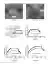 Fig. 22 - Hyperthermic vessel treatment devices and methods and kits utilizing the same