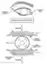 Fig. 01 - METHODS FOR TREATING EYE CONDITIONS