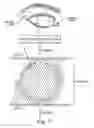 Fig. 08 - METHODS FOR TREATING EYE CONDITIONS