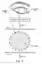 Fig. 09 - METHODS FOR TREATING EYE CONDITIONS