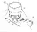 Fig. 01 - Patient interface for ophthalmologic diagnostic and interventional procedures