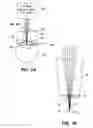 Fig. 03 - Patient interface for ophthalmologic diagnostic and interventional procedures