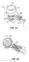 Fig. 09 - Patient interface for ophthalmologic diagnostic and interventional procedures