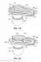 Fig. 20 - Patient interface for ophthalmologic diagnostic and interventional procedures