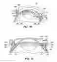 Fig. 22 - Patient interface for ophthalmologic diagnostic and interventional procedures