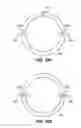 Fig. 34 - Patient interface for ophthalmologic diagnostic and interventional procedures