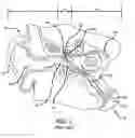 Fig. 02 - Eustachian tube dilation balloon with ventilation path