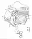 Fig. 06 - Eustachian tube dilation balloon with ventilation path
