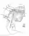 Fig. 07 - Eustachian tube dilation balloon with ventilation path