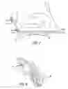 Fig. 08 - Eustachian tube dilation balloon with ventilation path