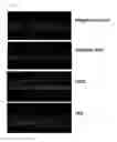 Fig. 04 - Composition for improving skin condition comprising chemokines