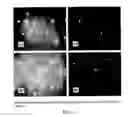 Fig. 04 - Carbohydrate-Derivatized Liposomes for Targeting Cellular Carbohydrate Recognition Domains of Ctl/Ctld Lectins, and Intracellular Delivery of Therapeutically Active Compounds