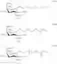 Fig. 09 - Inositol derivatives for use in pathological crystallization