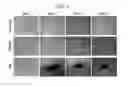 Fig. 02 - Method for inducing transdifferentiation of fibroblasts into chondrocytes