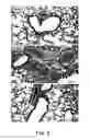 Fig. 09 - Attenuated strains