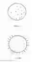 Fig. 07 - Method and apparatus for treating bone fractures, and/or for fortifying and/or augmenting bone, including the provision and use of composite implants