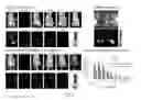 Fig. 07 - Photodynamic therapy composition
