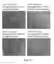 Fig. 09 - Photodynamic therapy composition
