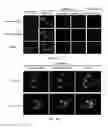 Fig. 08 - Compositions and methods for using albumin-based nanomedicines